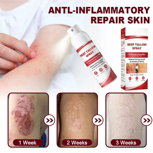 Beef Tallow Spray — The No-Rub Relief for Psoriasis-Prone Skin✨